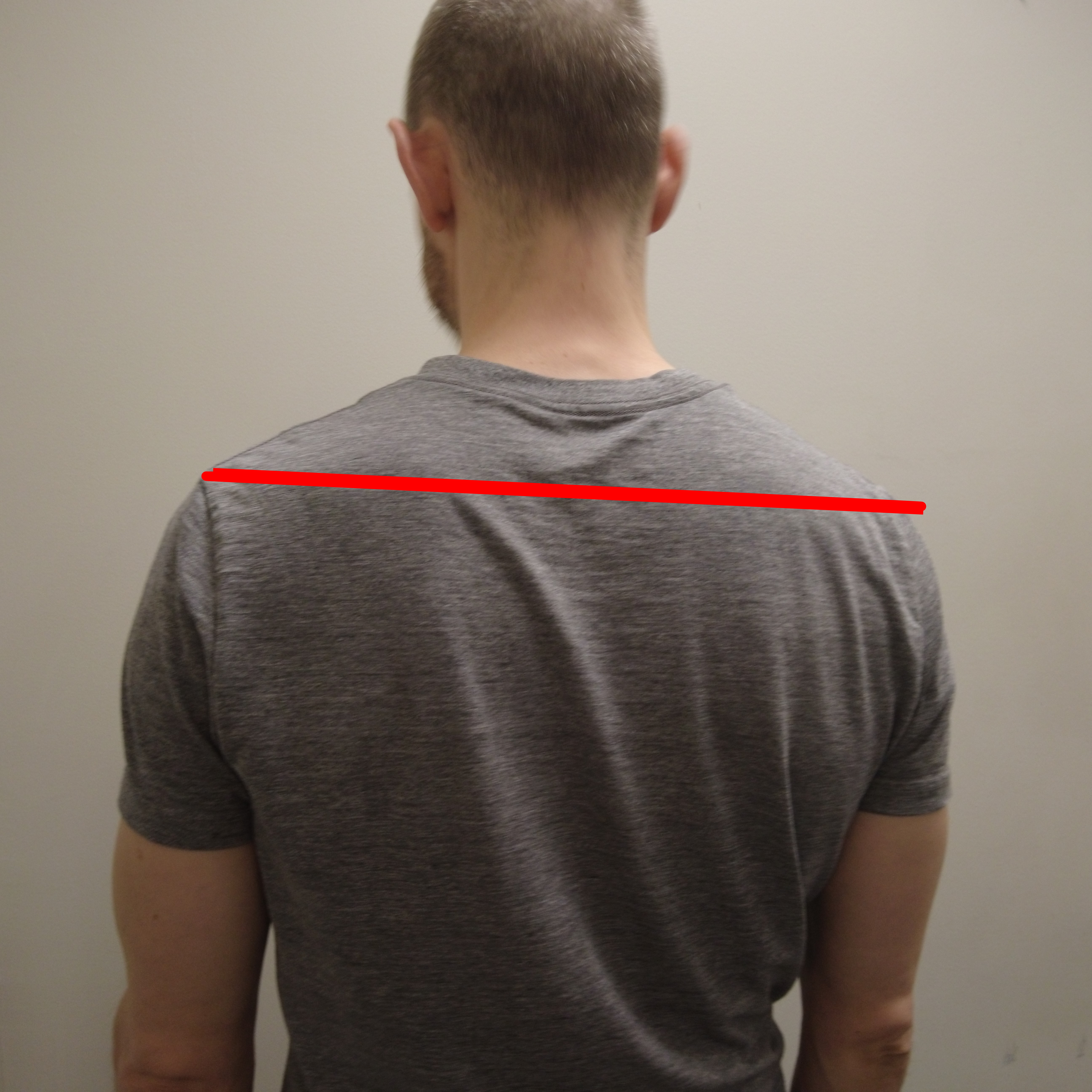 Man from behind with right shoulder lower than left