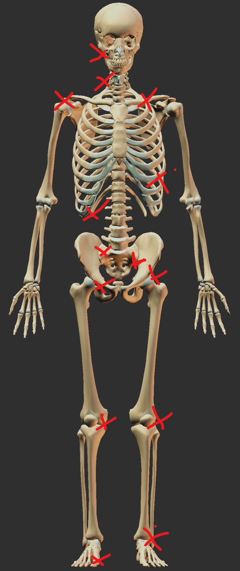 Skeleton with common sites of impingement or instability